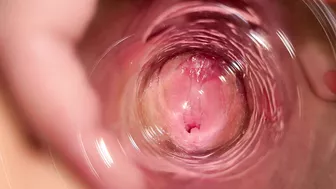 Camera Deep Inside Mia's Vagina