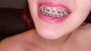 Girl With Braces Shows Her Mouth In Asmr