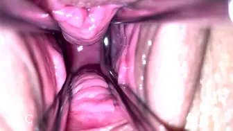 Fetish Gyno Vid With Handjob Cum