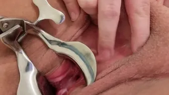 Bbw Shaved Pussy Stretched By Speculum And Cervix Play