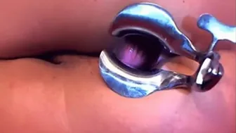 Cam Girl Anal Speculum By M.d.f