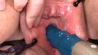 Stronic In My Peehole For The First Time